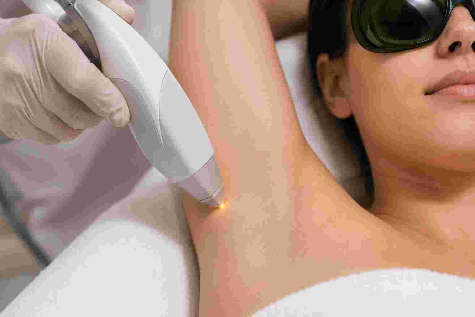 Underarms LHR Treatment